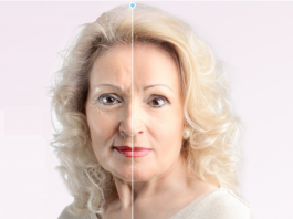 CleaDerm  - comentarios - opiniões - funciona - preço - onde comprar em Portugal - farmacia    