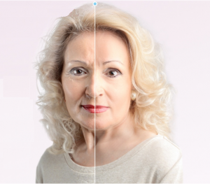 CleaDerm  - comentarios - opiniões - funciona - preço - onde comprar em Portugal - farmacia    