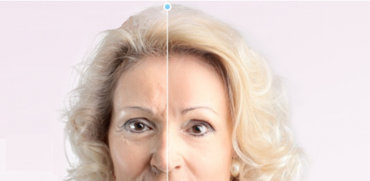 CleaDerm  - comentarios - opiniões - funciona - preço - onde comprar em Portugal - farmacia    